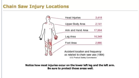 [Hearth.com] Eye protection