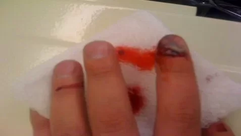 [Hearth.com] Husky splitter got me