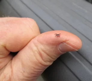 [Hearth.com] Tick bites and Lyme disease