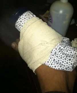 [Hearth.com] Could Not Scrounge This Weekend -- Bruised Ligament Ankle