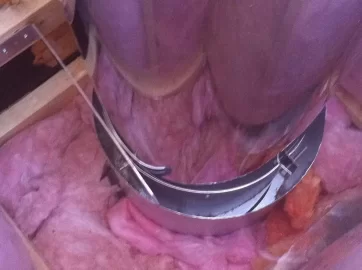 [Hearth.com] No Cap on Insulation Shield