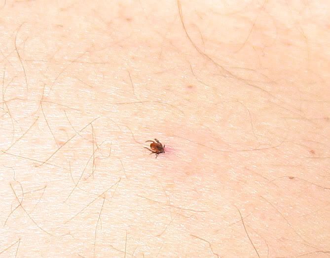 [Hearth.com] Bug I.D.